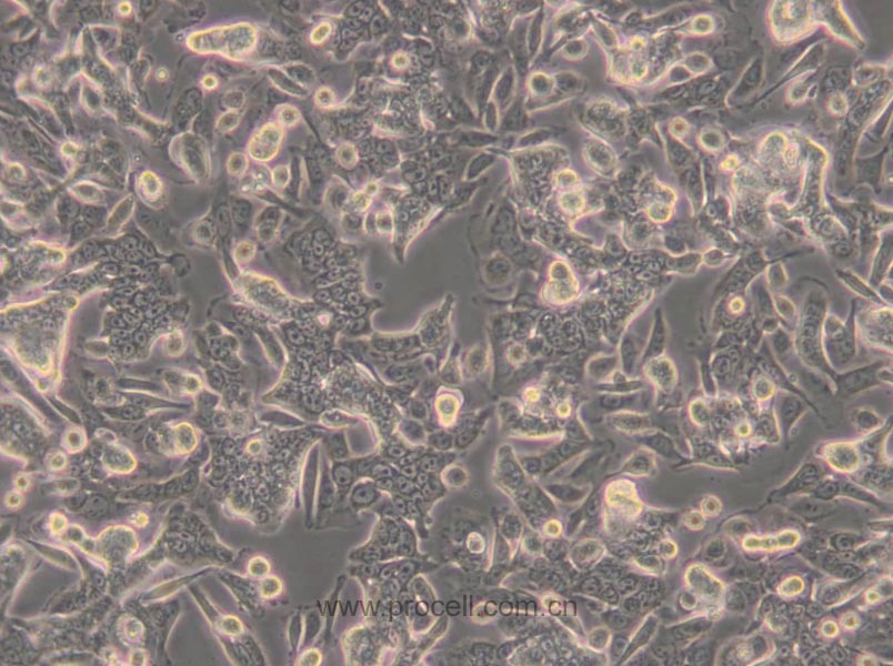 SW480 [SW-480] (人結(jié)腸癌細(xì)胞) (STR鑒定正確)