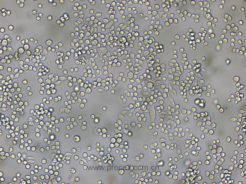 L6565 (小鼠白血病克隆細(xì)胞系) (種屬鑒定正確)