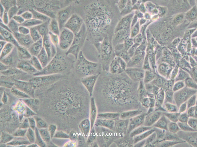 CTLA4 Ig-24 (中國倉鼠卵巢細胞)(種屬鑒定正確)