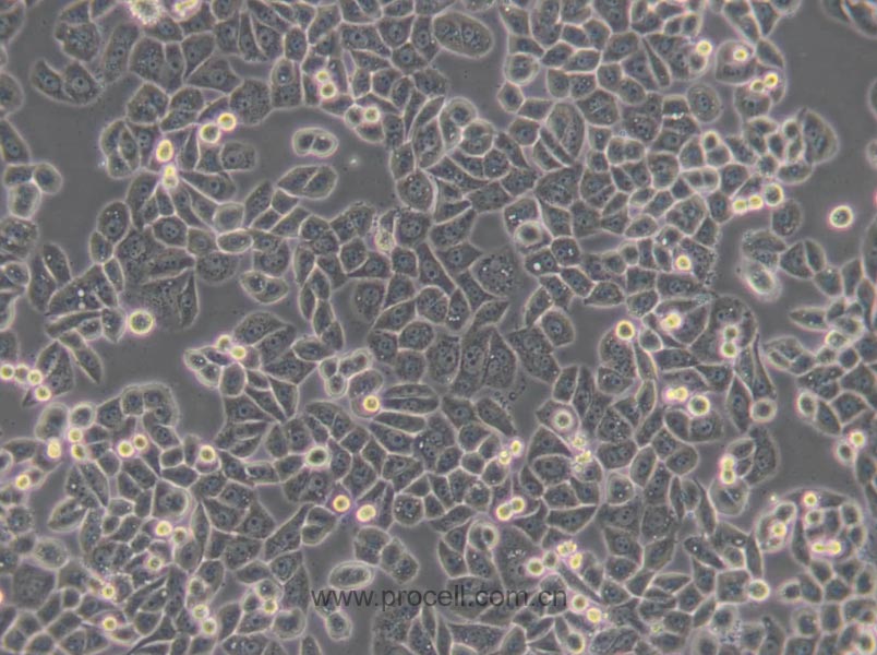 MDA-MB-468 (人乳腺癌細胞) (STR鑒定正確)