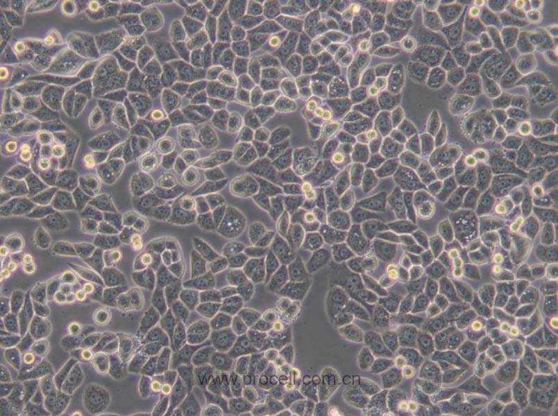 MDA-MB-468 (人乳腺癌細胞) (STR鑒定正確)