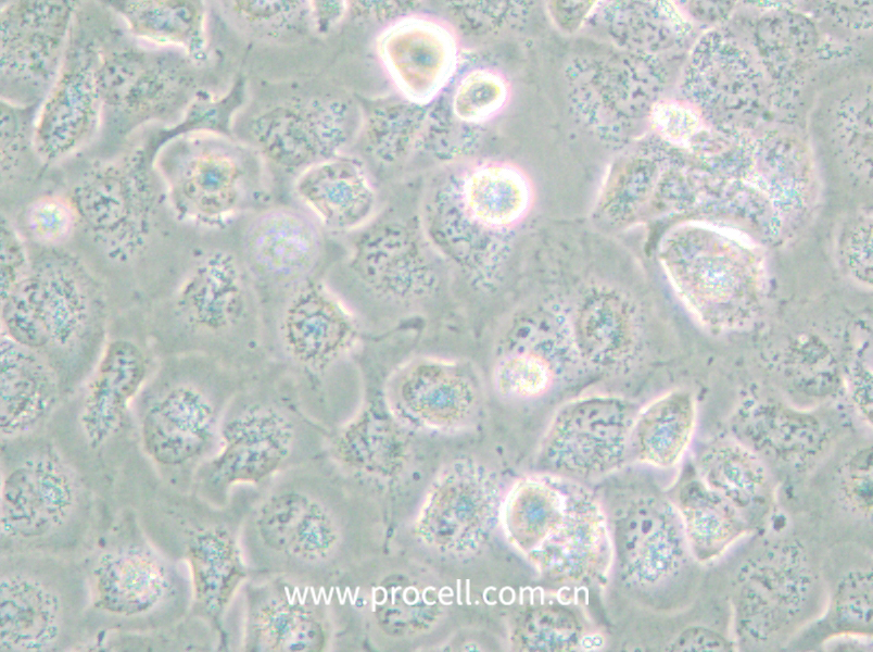 NCI-H661 (人大細(xì)胞肺癌細(xì)胞) (STR鑒定正確)