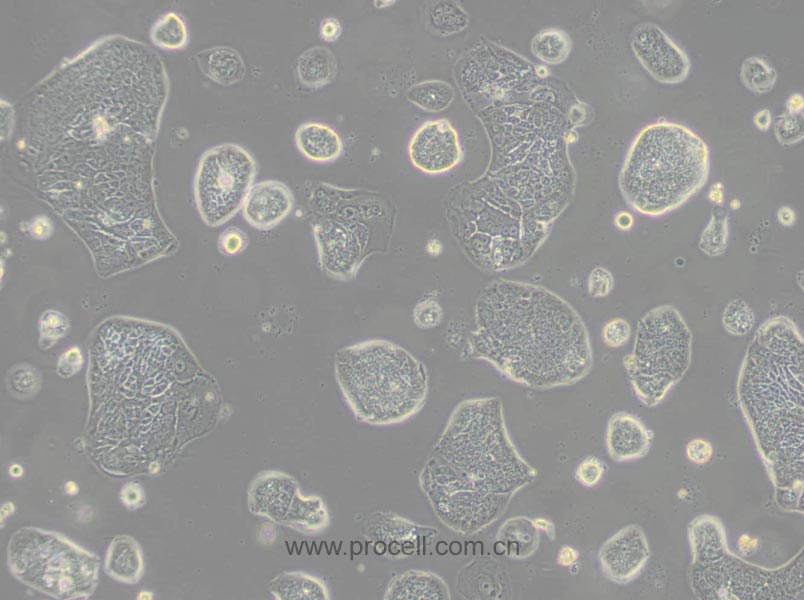 SW1116 (人結(jié)腸腺癌細胞) (STR鑒定正確)