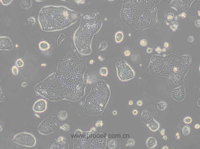 SW1116 (人結(jié)腸腺癌細胞) (STR鑒定正確)