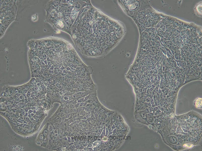 SW1116 (人結(jié)腸腺癌細胞) (STR鑒定正確)