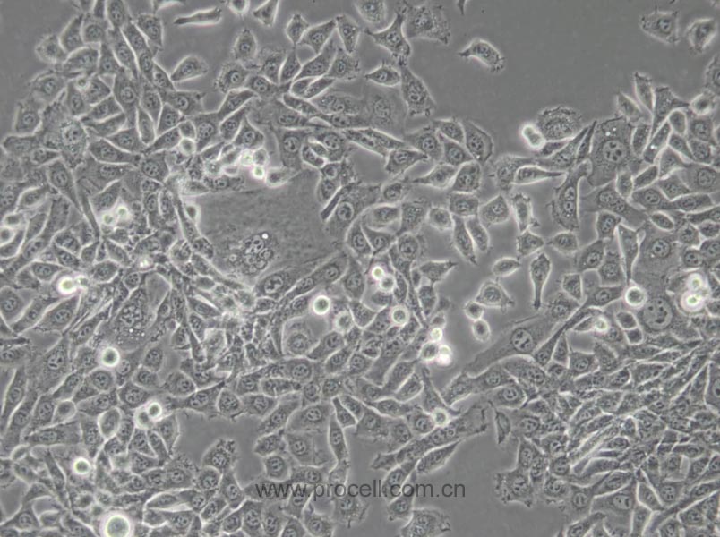 MDA-MB-415 (人乳腺癌細胞) (STR鑒定正確)