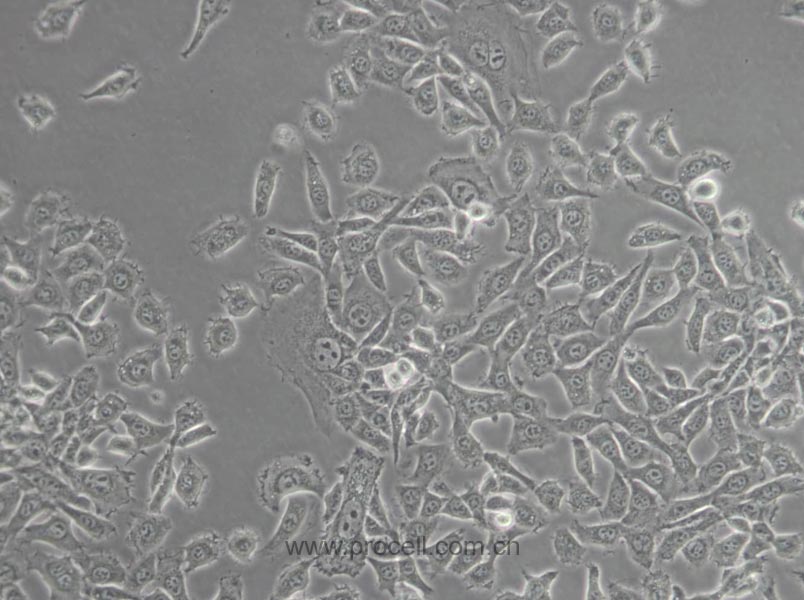 MDA-MB-415 (人乳腺癌細胞) (STR鑒定正確)