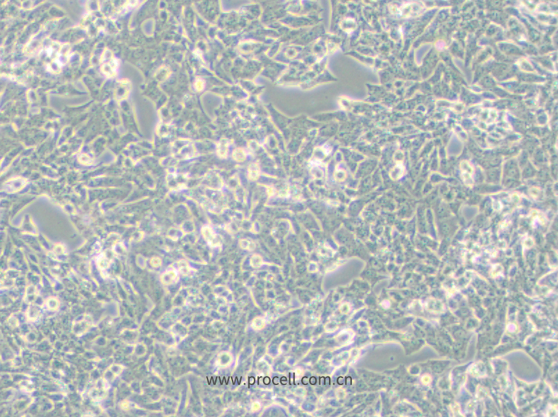 NCI-H295R (人腎上腺皮質(zhì)腺癌細(xì)胞) (STR鑒定正確)