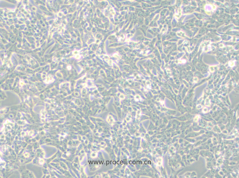 NCI-H295R (人腎上腺皮質(zhì)腺癌細(xì)胞) (STR鑒定正確)