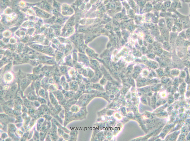 NCI-H295R (人腎上腺皮質(zhì)腺癌細(xì)胞) (STR鑒定正確)