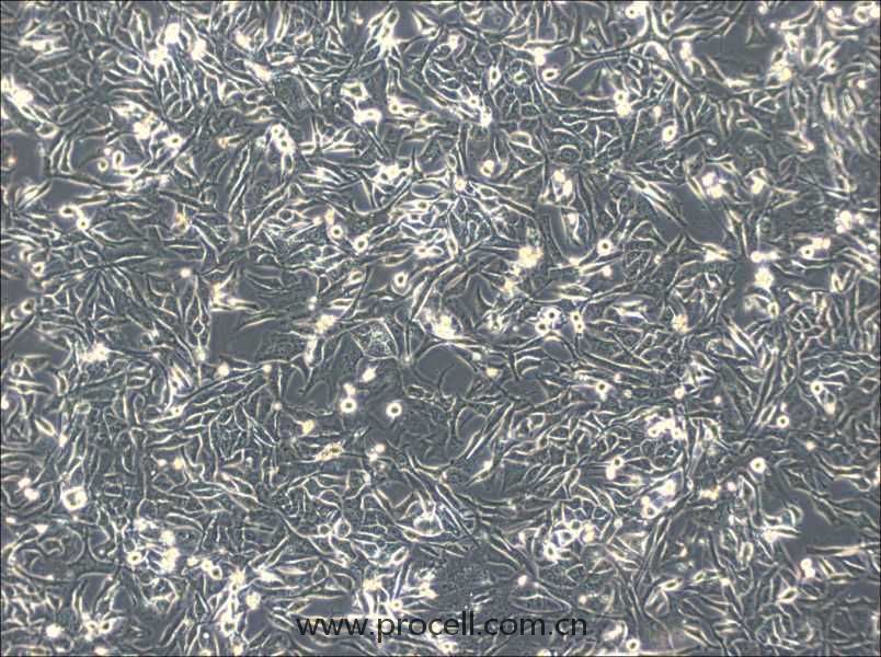 NCI-H596 (人肺腺鱗癌細胞) (STR鑒定正確）