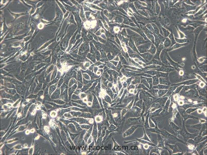 NCI-H596 (人肺腺鱗癌細胞) (STR鑒定正確）