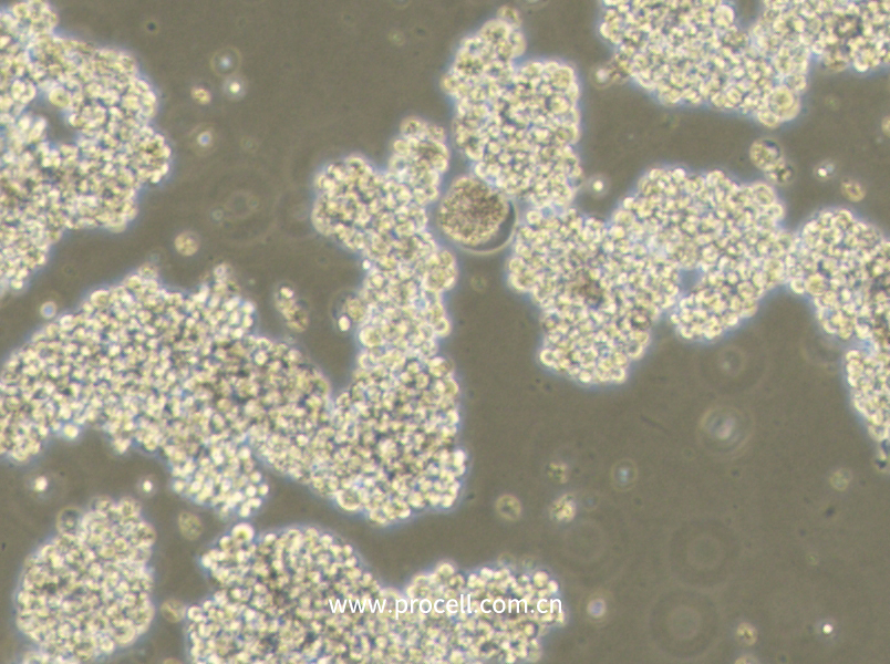 NCI-H716 [H716] (人結(jié)直腸腺癌細胞) (STR鑒定正確)