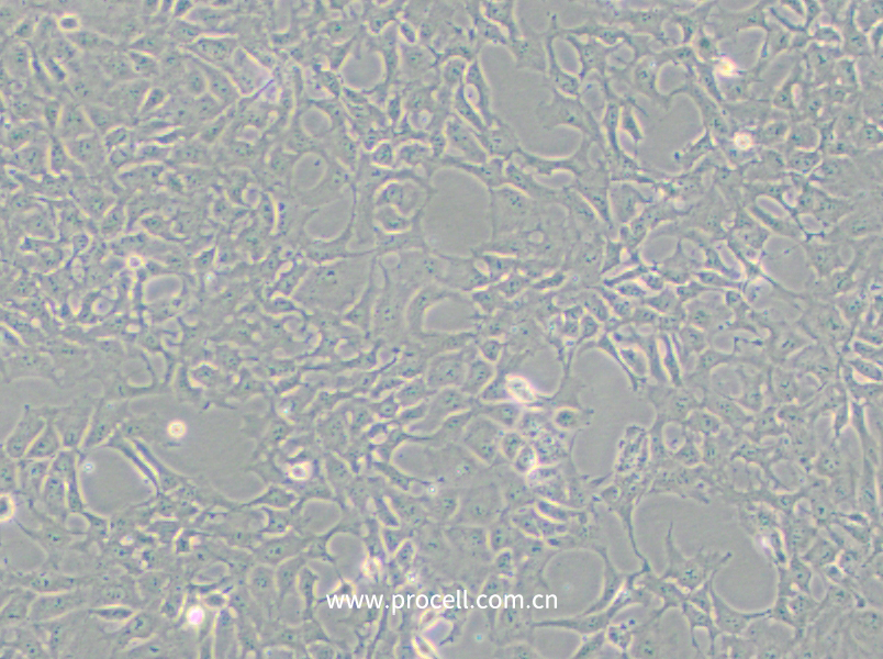 PA-1 (人卵巢畸胎瘤細(xì)胞)(STR鑒定正確)