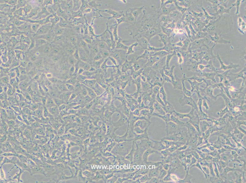 PA-1 (人卵巢畸胎瘤細(xì)胞)(STR鑒定正確)