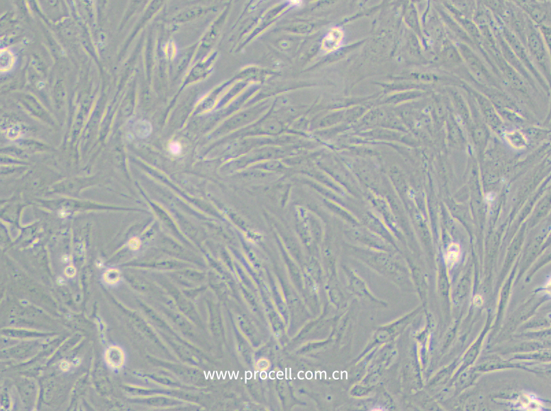 SF126 (人腦瘤細(xì)胞)(STR鑒定正確)