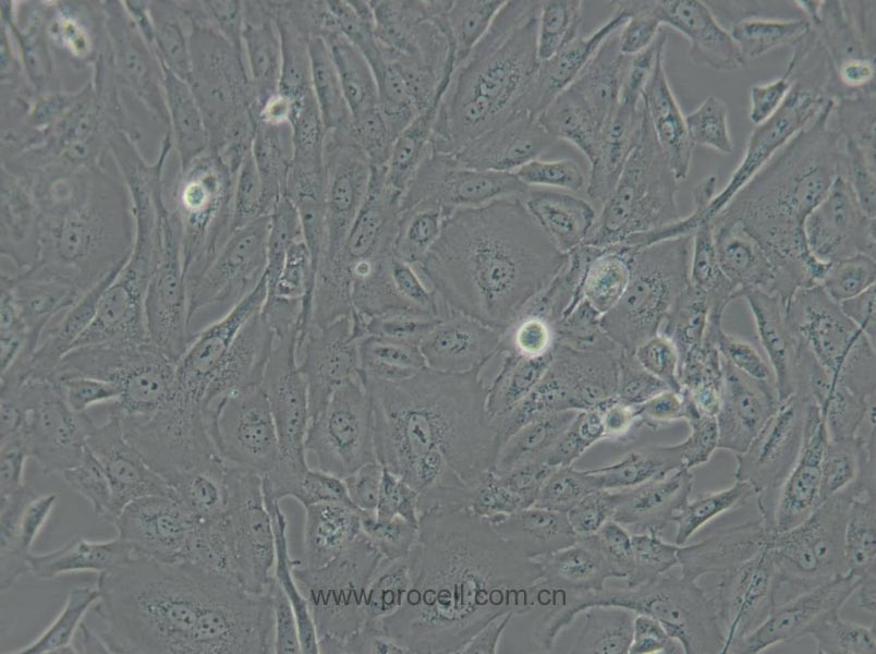 SW 1353 (人軟骨肉瘤細(xì)胞) (STR鑒定正確)