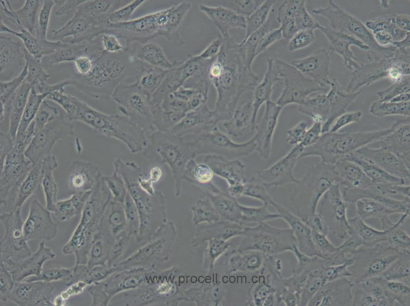 SW 1353 (人軟骨肉瘤細(xì)胞) (STR鑒定正確)