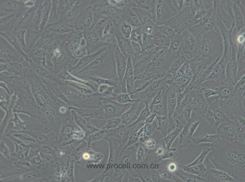 SW 1353 (人軟骨肉瘤細(xì)胞) (STR鑒定正確)