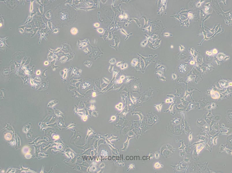 SW 780 [SW-780, SW780] (人膀胱移行細(xì)胞癌) (STR鑒定正確)