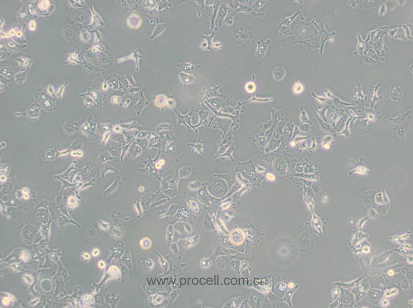 SW 780 [SW-780, SW780] (人膀胱移行細(xì)胞癌) (STR鑒定正確)