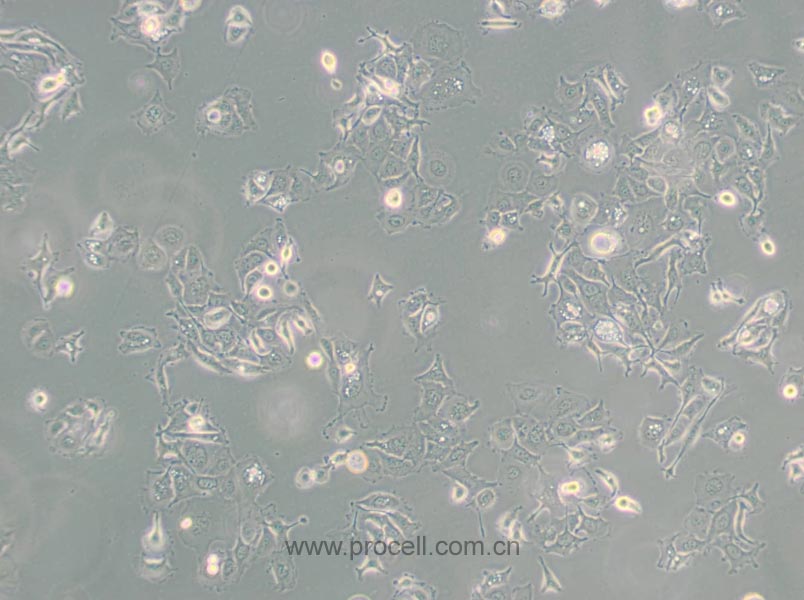 SW 780 [SW-780, SW780] (人膀胱移行細(xì)胞癌) (STR鑒定正確)