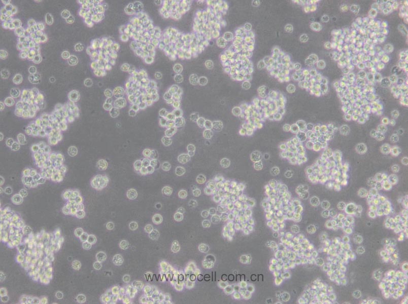 L5178Y TK+/- clone(3.7.2C) (小鼠淋巴瘤細(xì)胞) (STR鑒定正確)