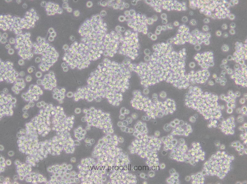 L5178Y TK+/- clone(3.7.2C) (小鼠淋巴瘤細(xì)胞) (STR鑒定正確)