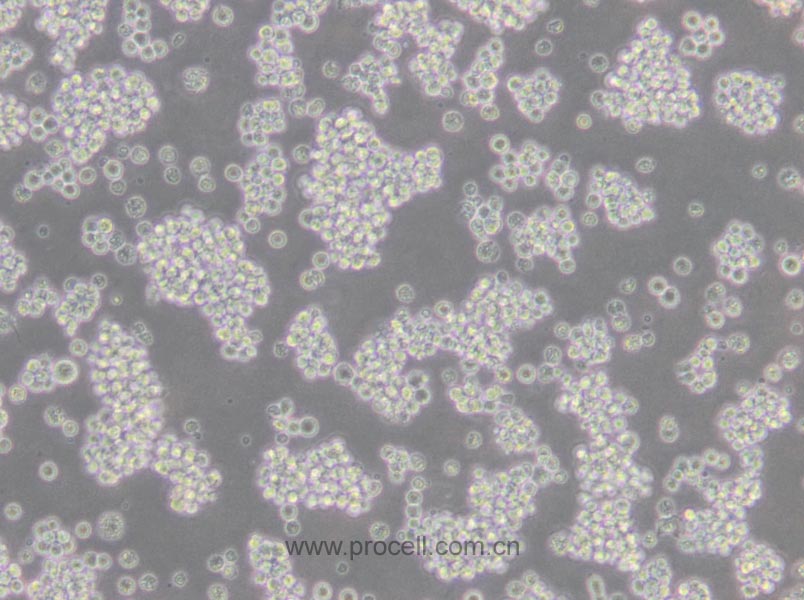 L5178Y TK+/- clone(3.7.2C) (小鼠淋巴瘤細(xì)胞) (STR鑒定正確)