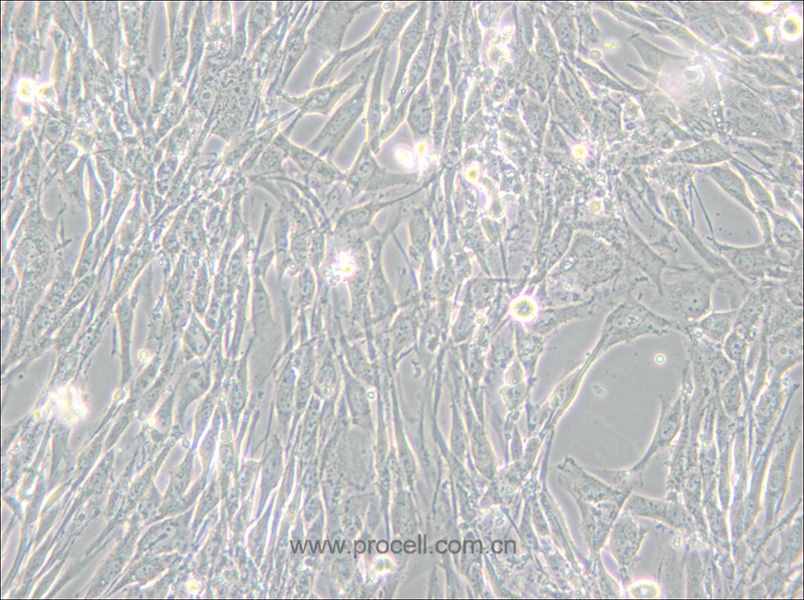 U-118 MG (人腦星形膠質(zhì)母細(xì)胞瘤) (STR鑒定正確)