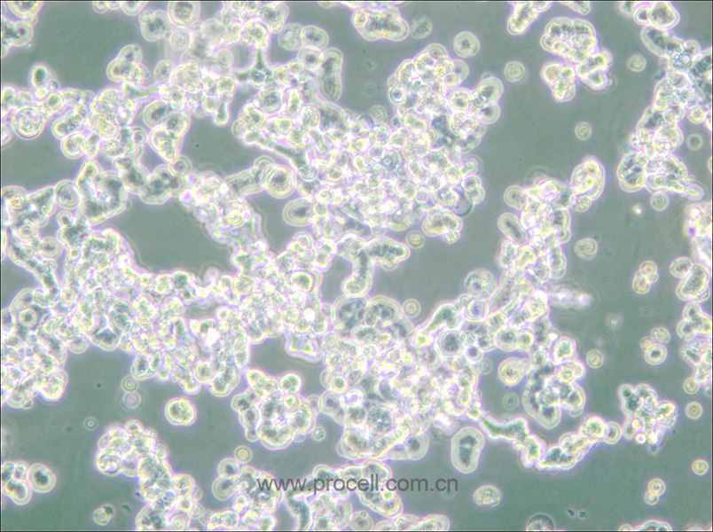 WERI-Rb-1 (人視網(wǎng)膜神經(jīng)膠質(zhì)瘤細(xì)胞) (STR鑒定正確)