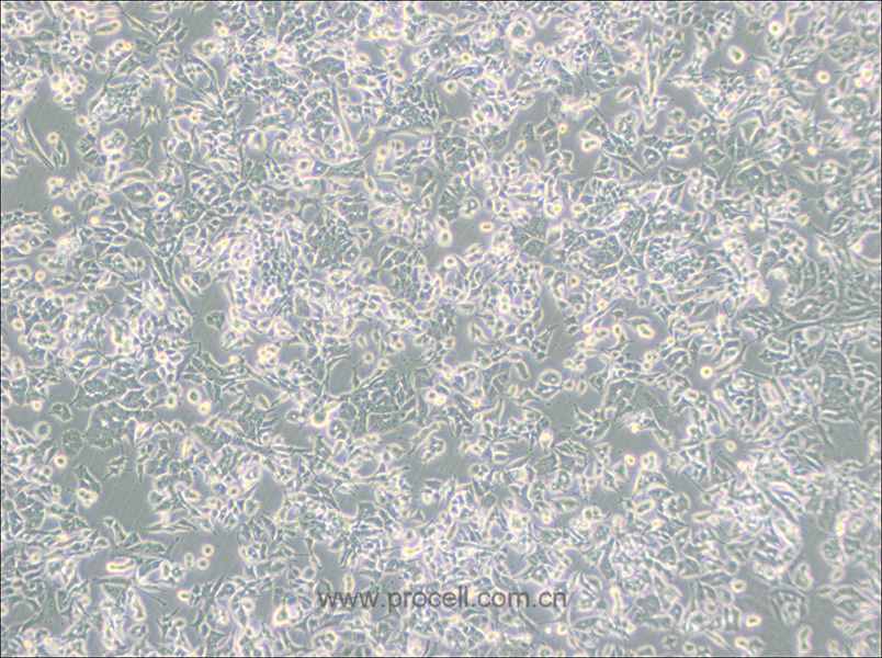 PC-12(Low differentiation) (大鼠腎上腺嗜鉻細胞瘤細胞(低分化)) (種屬鑒定正確)