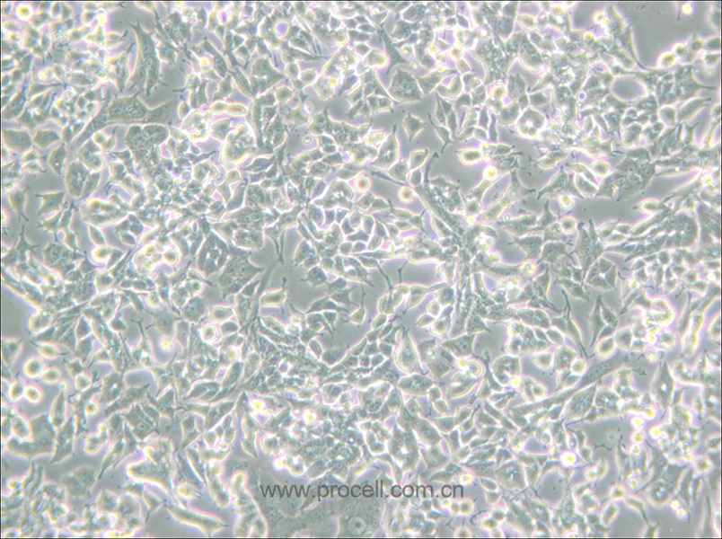 PC-12(Low differentiation) (大鼠腎上腺嗜鉻細(xì)胞瘤細(xì)胞(低分化)) (種屬鑒定正確)