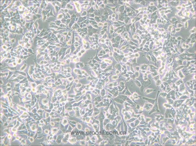 PC-12(Low differentiation) (大鼠腎上腺嗜鉻細(xì)胞瘤細(xì)胞(低分化)) (種屬鑒定正確)