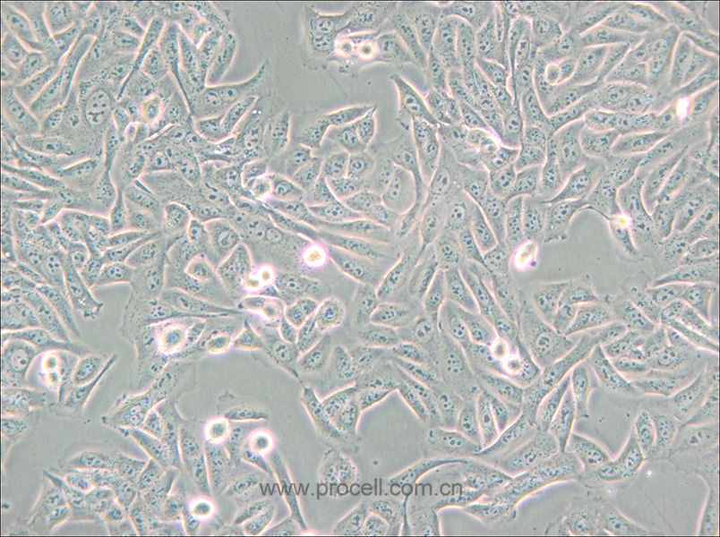 MNNG/HOS Cl #5 [R-1059-D] (人骨肉瘤細(xì)胞) (STR鑒定正確)