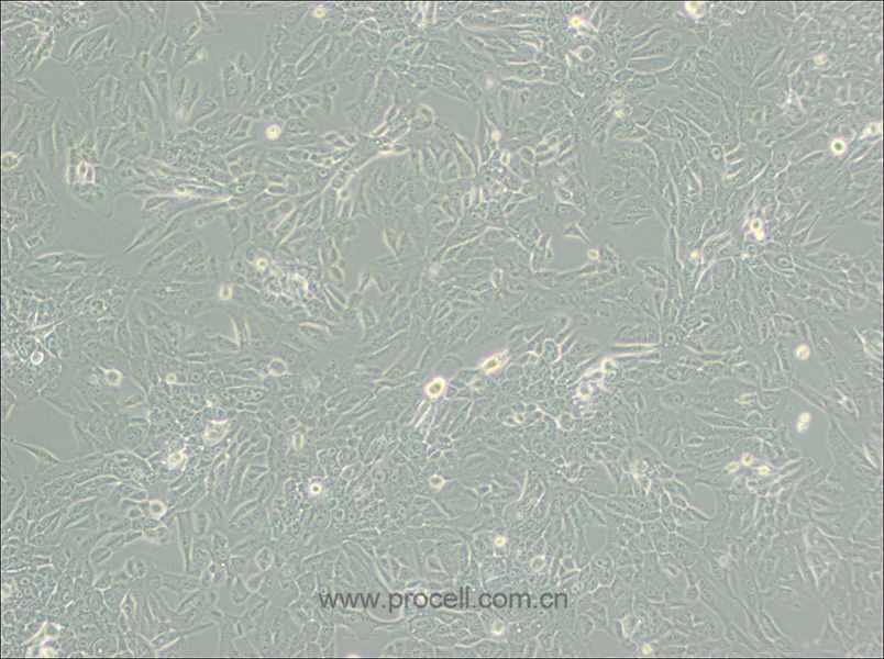 MCF 10A (人正常乳腺上皮細(xì)胞) (STR鑒定正確)