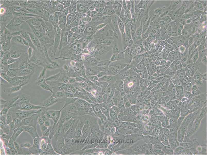 MCF 10A (人正常乳腺上皮細胞) (STR鑒定正確)