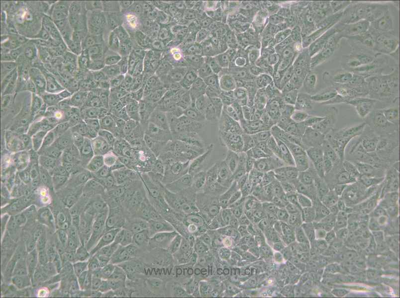 MCF 10A (人正常乳腺上皮細胞) (STR鑒定正確)