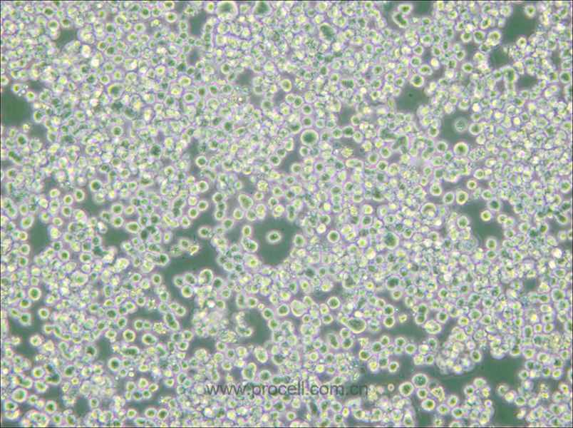 RPMI 8226 (人多發(fā)性骨髓瘤外周血B淋巴細(xì)胞) (STR鑒定正確)