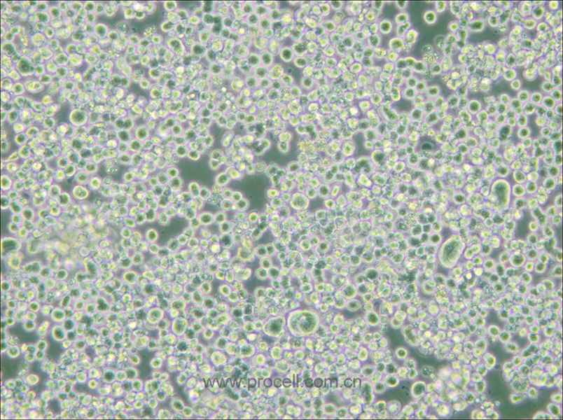 RPMI 8226 (人多發(fā)性骨髓瘤外周血B淋巴細(xì)胞) (STR鑒定正確)