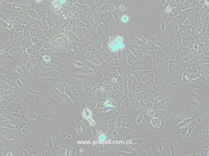 SCC-9 [SCC 9; SCC9] (人舌鱗癌細(xì)胞) (STR鑒定正確)