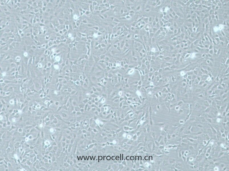 HMEC-1 (人微血管內(nèi)皮細(xì)胞) (STR鑒定正確)