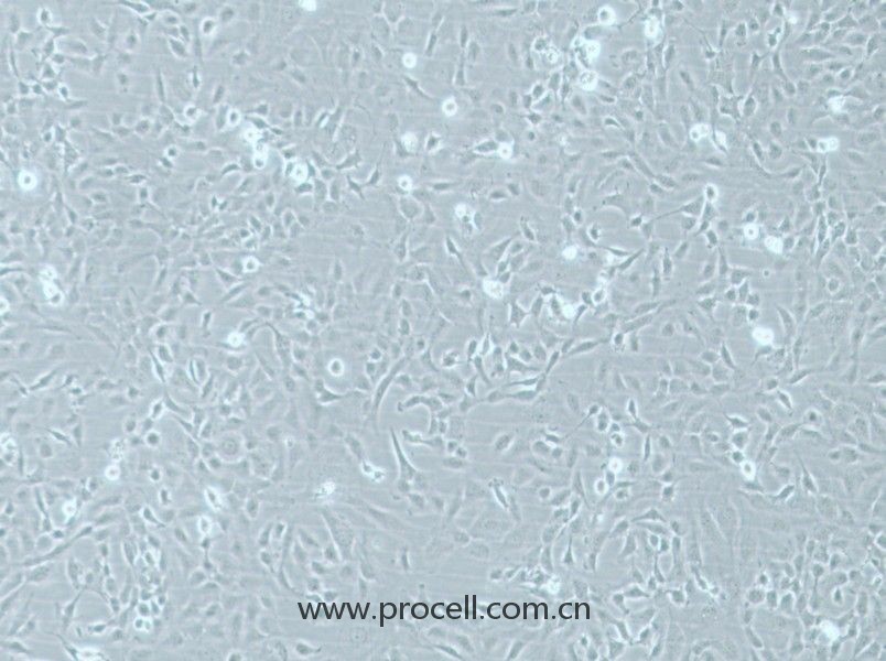 HMEC-1 (人微血管內(nèi)皮細(xì)胞) (STR鑒定正確)