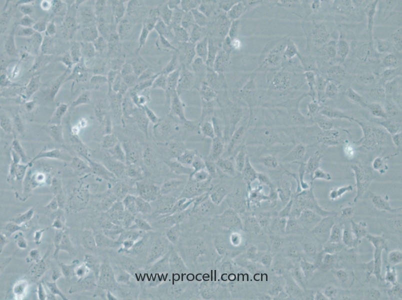 HMEC-1 (人微血管內(nèi)皮細(xì)胞) (STR鑒定正確)