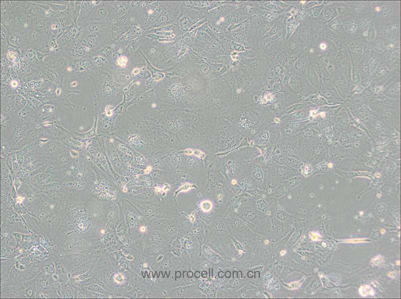 NCI-H2347 (人肺癌細(xì)胞) (STR鑒定正確)