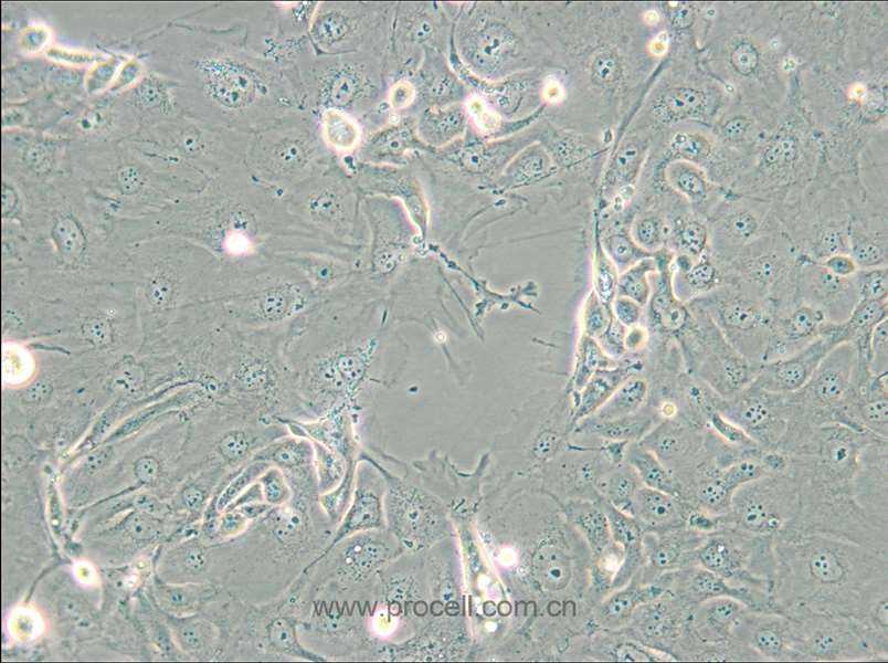 NCI-H2347 (人肺癌細(xì)胞) (STR鑒定正確)