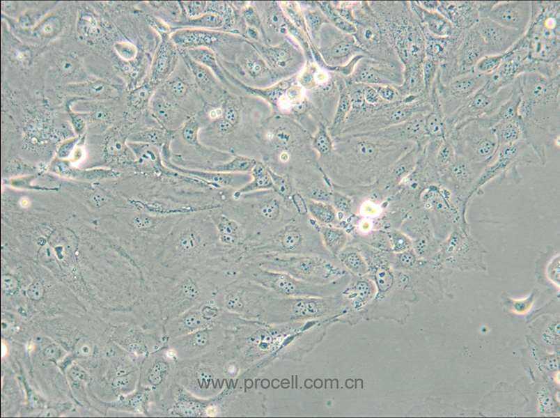 NCI-H2347 (人肺癌細(xì)胞) (STR鑒定正確)