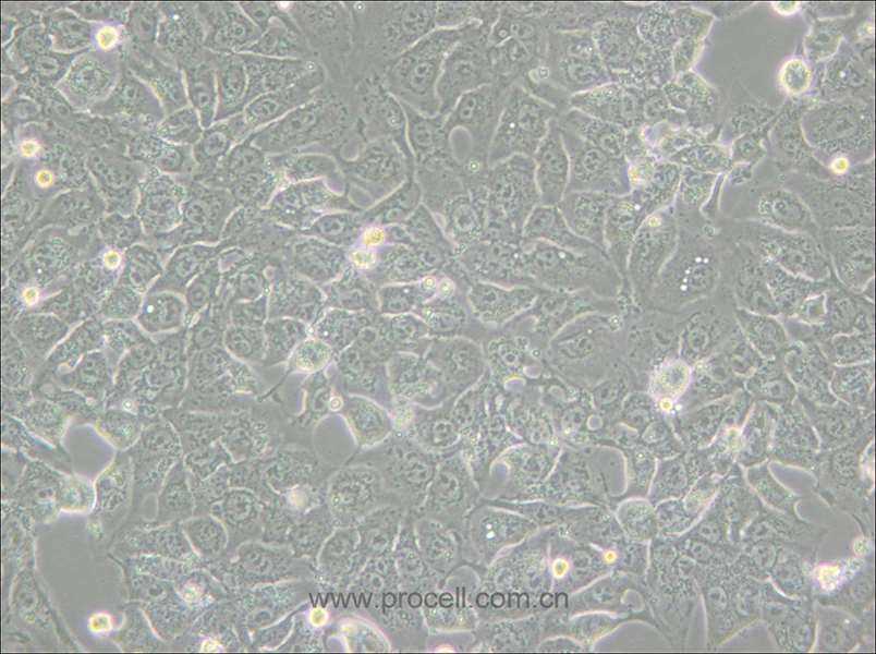 BHT101 (人甲狀腺癌細(xì)胞(未分化)) (STR鑒定正確)