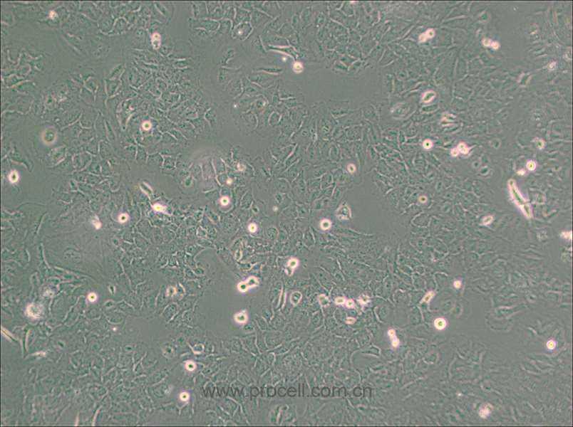 HMC3 (人小膠質(zhì)細(xì)胞) (STR鑒定正確)