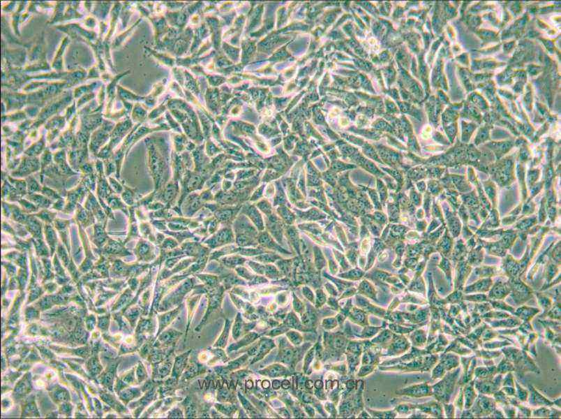 SUM159PT (人乳腺癌細(xì)胞系) (STR鑒定正確)